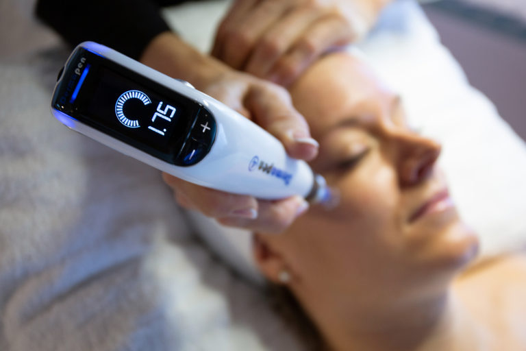 Microneedling med dermapen