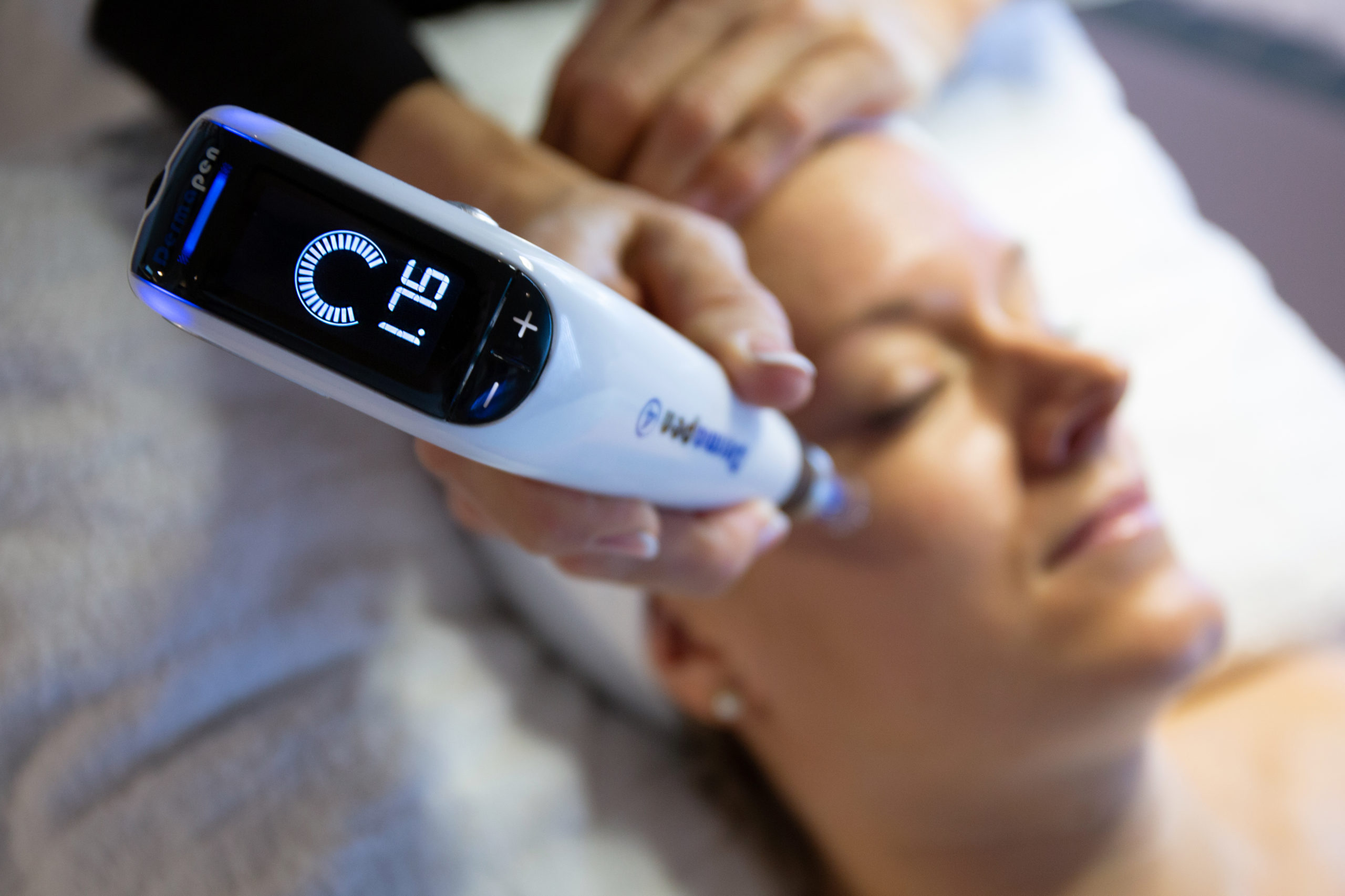 Microneedling med dermapen